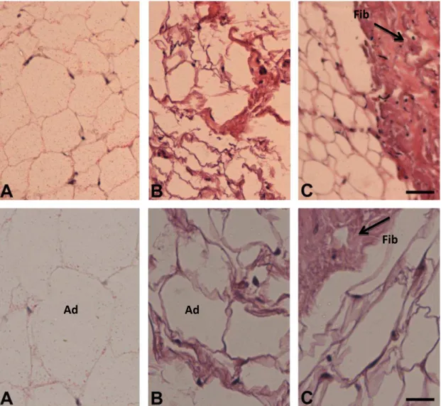Figura 2. Características Morfológicas do Tecido Adiposo Subcutâneo. Coloração com hematoxilina e                                             eosina do grupo C (A) (n=5) e do grupo TC (B, C) (n=5)