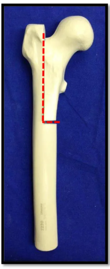 Figura 4- Modelo artificial de fêmur marca Synbone ®  com marcação para a  osteotomia em “L”