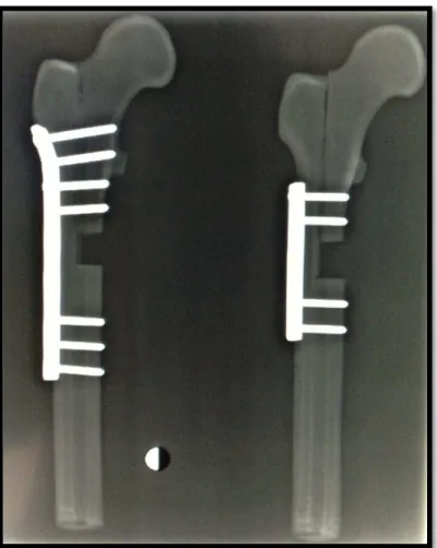 Figura 8  – Rx dos modelos ósseos após a osteotomia e fixados com  placa do  Grupo 1 e Grupo 2