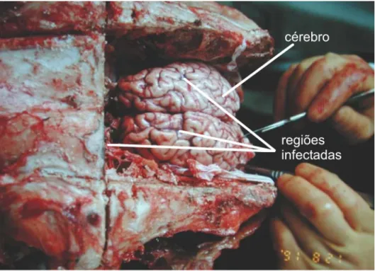 Figura 3 – Cérebro de animal contaminado com BSE. [Retirado de niah.naro.affrc.go.jp] 