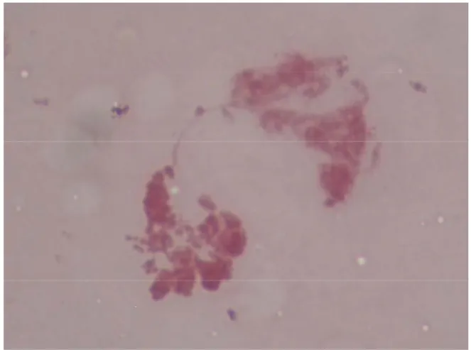 Figura 3. Morfologia dos cromossomos de ovócito tratado com actinomicina D com 5  µg ml - ¹ por 14 horas