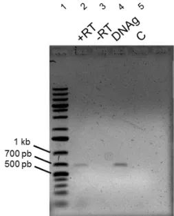 Figura  8.  Análise  da  expressão  da  ORF  PAS_chr3_0283.  Eletroforese  em  gel  de  agarose  1% 