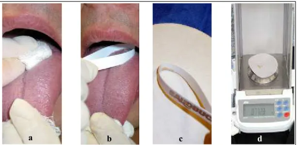 FIGURA 7 – a) remoção do excesso de umidade da língua; b) remoção da saburra; 