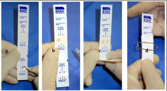 FIGURA 8  - a) colocação da saburra na fita teste com colher de dentina;  b)  colocação de água destilada na fita teste;  c) dobragem  da fita;  d)  fita presa com clipe de papel 