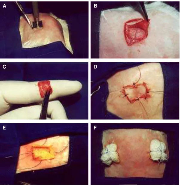 Figura 6 - Fotografias ilustrativas das etapas do procedimento cirúrgico. A)  Ressecção de um quadrado de pele de 2 cm de lado na região escapular, utilizando  um molde de aço inoxidável