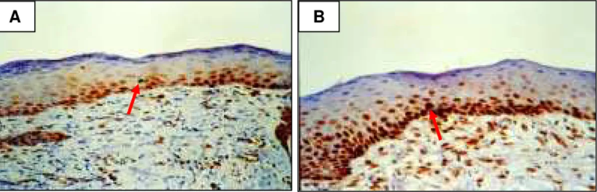 FIGURA 10 - Fotomicrografia corada com PCNA (imunohistoquímica) em  secção longitudinal de pele de coelho após enxerto de pele total