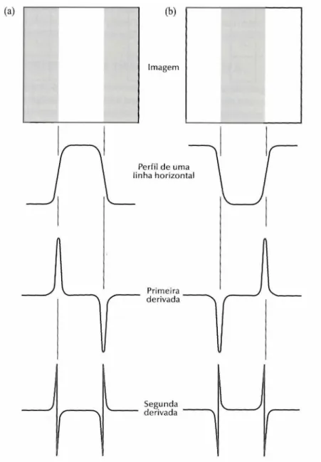 Figura 26: Detecção de bordas por operadores de derivação 2