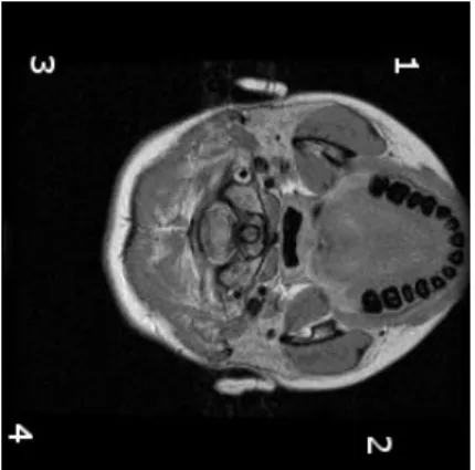 Figura 35: Imagem do arquivo brain1234 com uma rotação anti-horária 