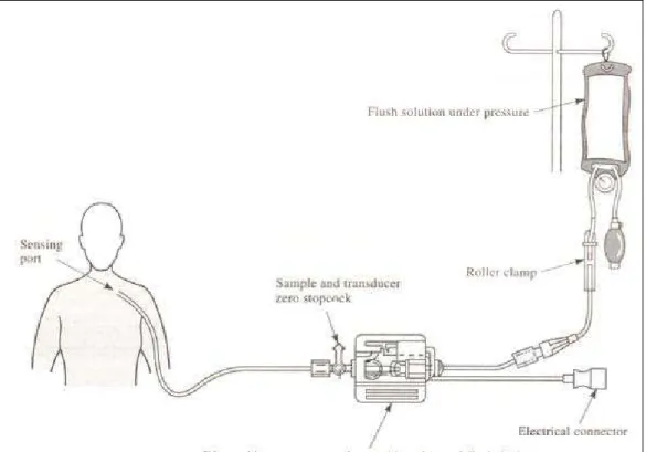 Figura 5: Sistema de Medição de Pressão com Sensor Extravascular 