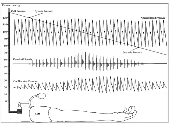 Figura 6: Medição de Pressão Não-Invasiva: Oscilométrica e Auscultatória 