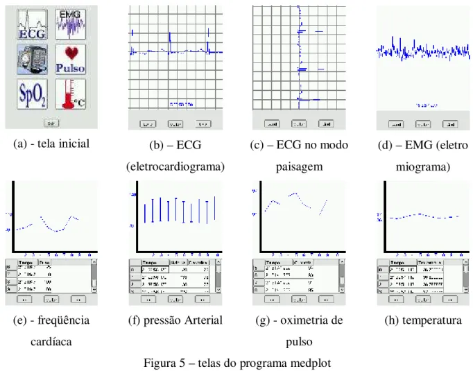 Figura 5 – telas do programa medplot  Fonte: Ortis et all(2004) 