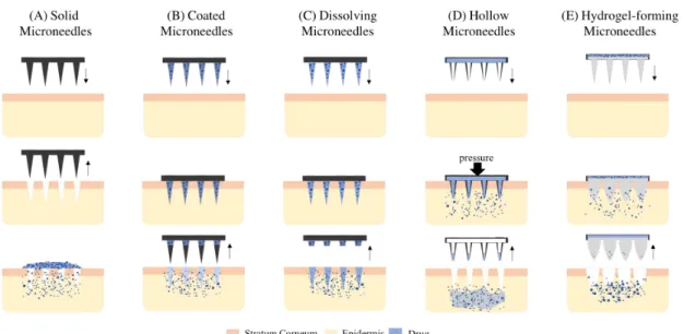 Figure 1.3: Types of microneedles-based transdermal drug delivery: solid (A), coated (B), dissolving (C) hollow (D) and hydrogel-forming (E) microneedles