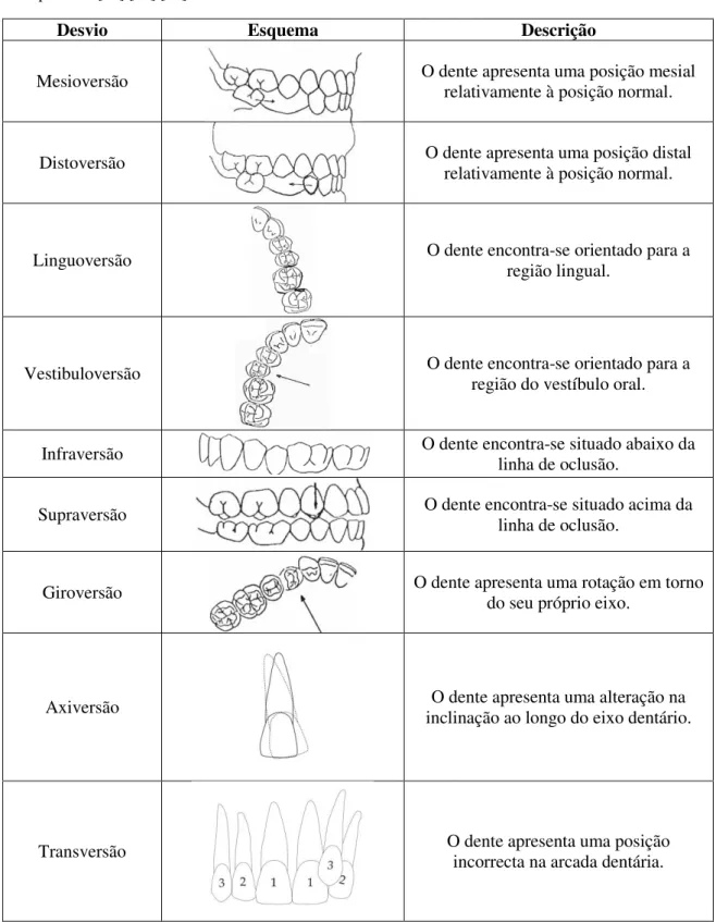 Tabela  1.1  –   Desvios  verificados  nas  posições  individuais  dos  dentes  segundo  a  descrição  de  Lischer