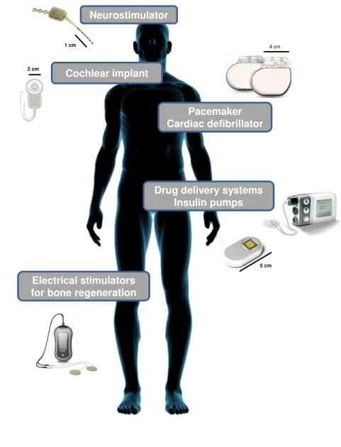 Figure 1.2: An overview of the most common active IMDs that can be found in the human body.