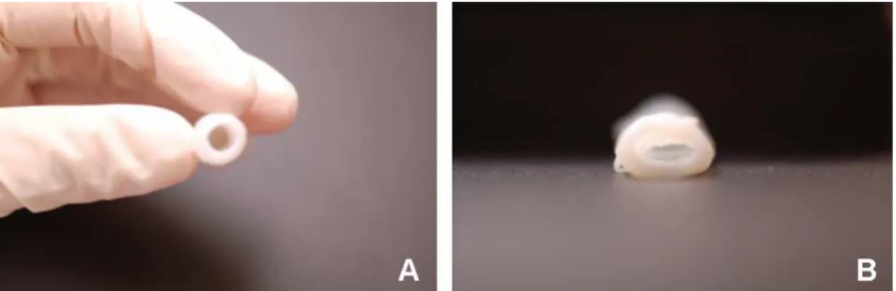 Figure 1.9: Decellularized human umbilical vein. a. Tissue decellularized through luminal perfusion.
