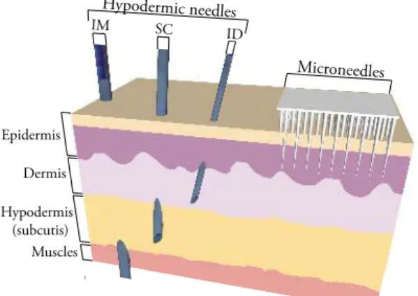 Figure 1.2: Hypodermic needles versus Microneedles. Adapted from N. R. Hegde et al. [13]