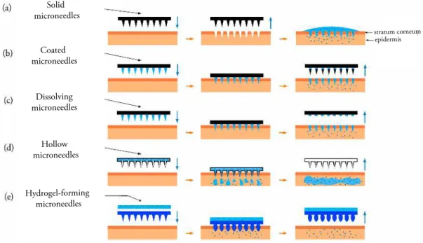Figure 1.3: Types of microneedles. Adapted from A. Rzhevskiy et al. [6]