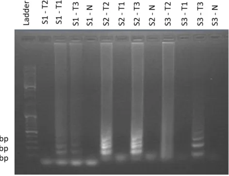 Figure 6 Gel electrophoresis result for LAMP reaction with T1, T2 and T3 being combined with S1, S2 and  S3