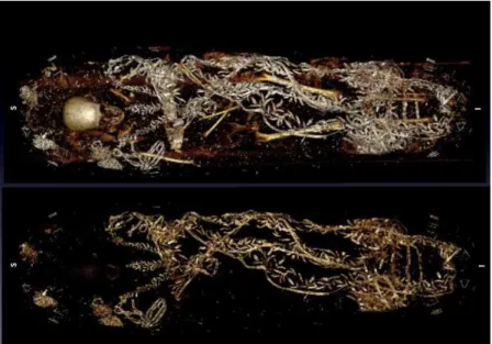 Figura 55 - Tomografia nos remanescentes humanos de D.Leopoldina. Observamos o corpo e as  partes brilhantes que correspondem aos metais das vestes