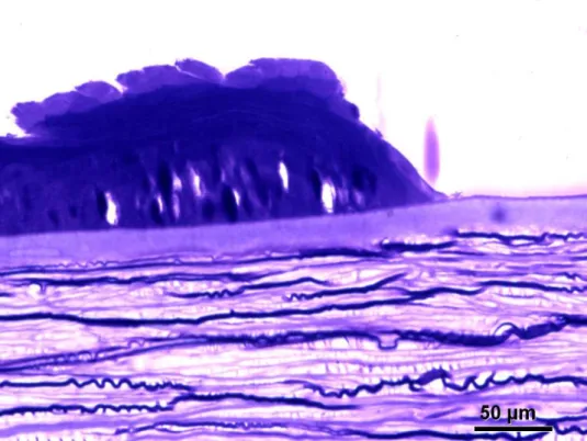 Figura 4: Microscopia óptica do espécime contendo epitélio, camada de Bowman e  estroma superficial da região periférica adjascente à área debridada da córnea n o  4  (Azul de Richardson, 400X)