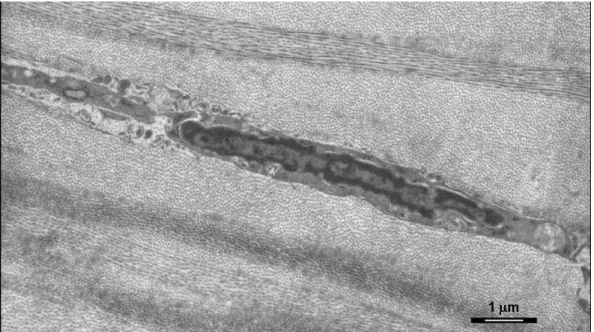 Figura 13: Microscopia eletrônica de transmissão contendo ceratócito em processo de morte  celular programada (apoptose) a cerca de 50µm da superfície debridada da córnea no 4