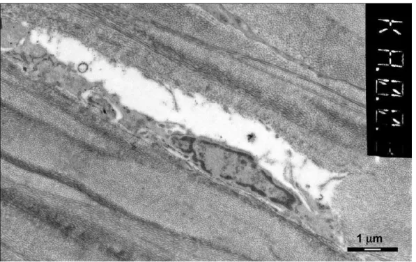Figura 15: Microscopia eletrônica de transmissão contendo ceratócito em processo de morte celular  programada no estroma superficial, a cerca de 50µm da superfície debridada da córnea n o  7