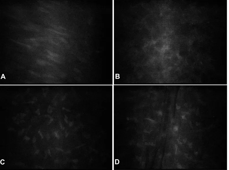 Figura 17: Imagens do exame de microscopia confocal “in vivo” da córnea do caso n o  1