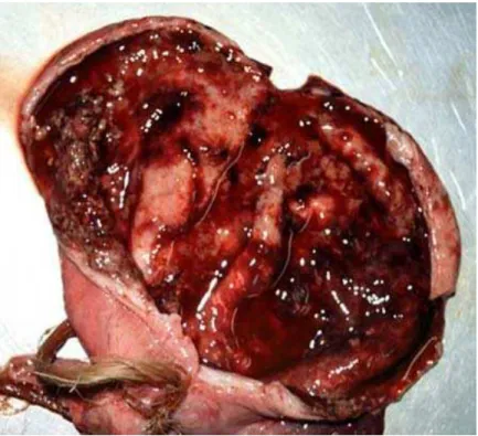 Figura 4 - Lesões macroscópicas em bexiga de fêmea suína compatíveis com infecção por  Actinobaculum suis: parede espessada e mucosa com superfície hemorrágica e  purulenta 