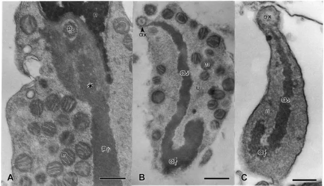 Fig. 2. Spermatozoa of E. flavopictus. Transmission electron micrographs of the midpiece and  tail