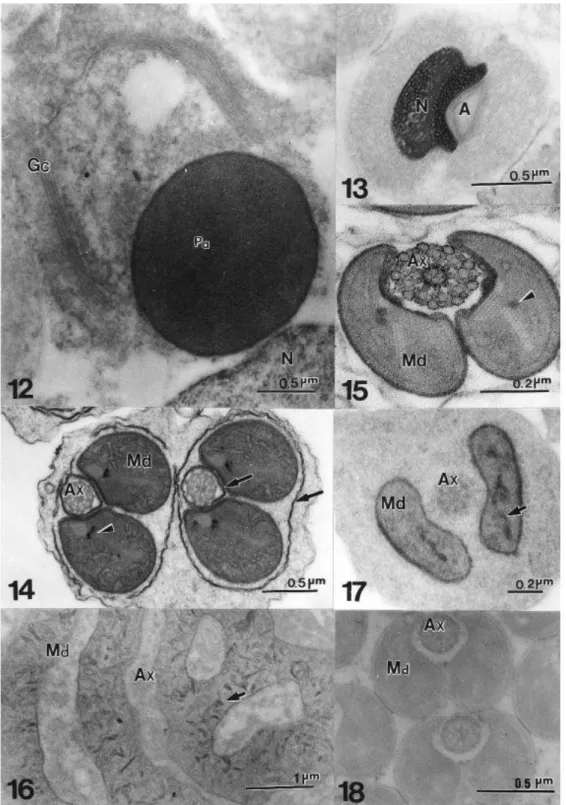Figs 12 – 15 Localization of thiamine pyrophosphatase  in A. aseadum  spermatids. Fig