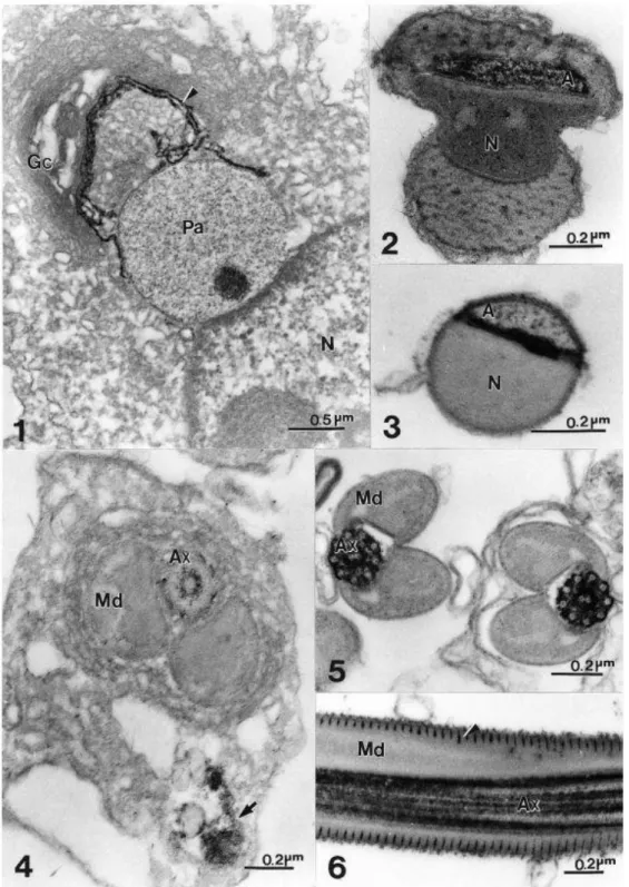 Figs  1 – 3  Localization  of  acid  phosphatase  activity.  Fig.  1  The  reaction  product  is  associated  with  trans  Golgi and trans Golgi network (arrowhead) on N