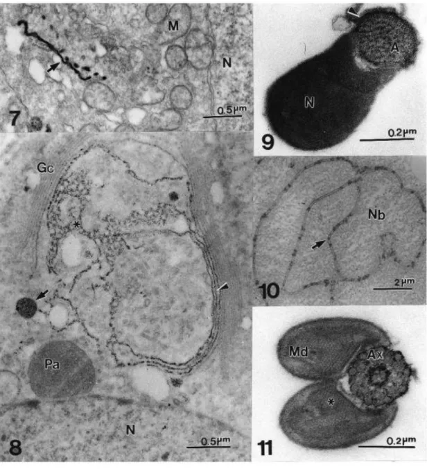 Figs 7 – 11 Localization of glucose-6-phosphatase activity. Fig. 7 Early spermatid of A