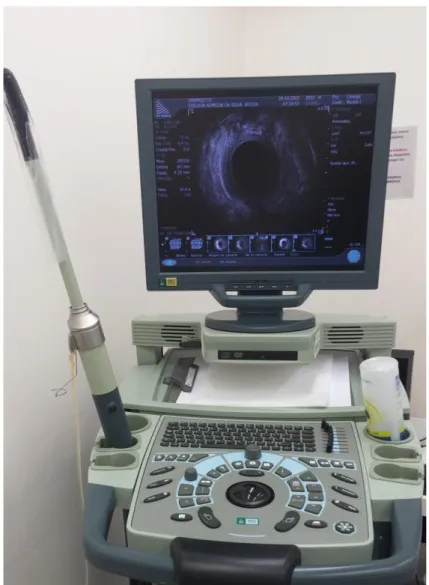 Figura  2.  Aparelho  de  ultrassonografia  com  estação  de  trabalho  e  transdutor  acoplados,  onde foram geradas todas as imagens do estudo