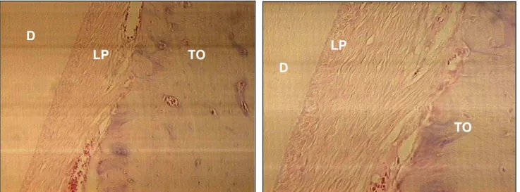 Figura 15 – Tecido ósseo (TO) organizado, poucas  linhas de aposição, ligamento periodontal (LP),  contorno regular da dentina (D), H.E., original 40x