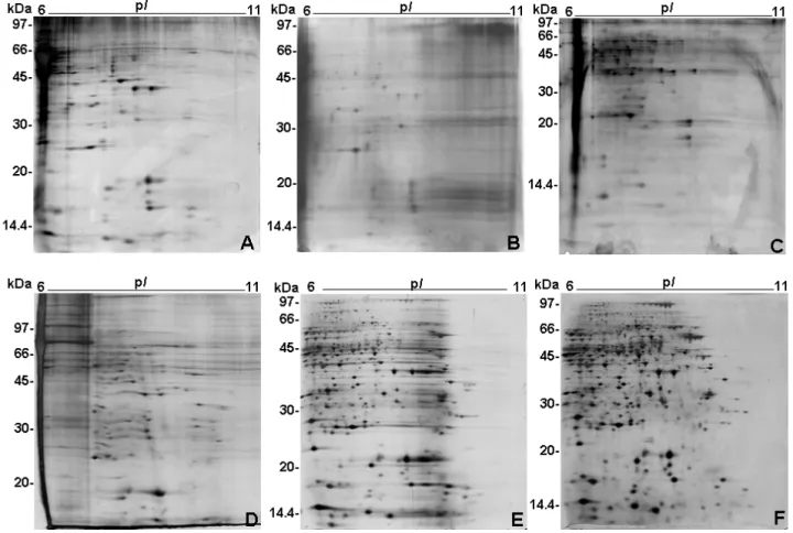 Fig. 1A presents the 2-DE profile resolved by method A, showing few intense silver stained spots and mild  hori-zontal streaking, specially in the high apparent molecular mass region.