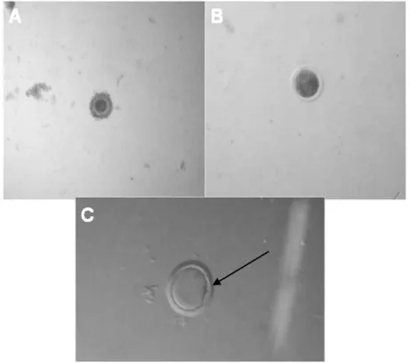 Figura 7. Fotomicrografias de oócitos bovinos. Observa-se em (A) um oócito imaturo, em (B)  oócito desnudo e em (C) oócito maturo