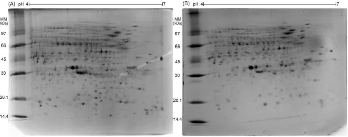 Figura  7.  Perfis  dos  extratos  protéicos  das  amostras  de  mangas  da  cultivar  Keitt  em  2D-PAGE  (12,5%  acrilamida)