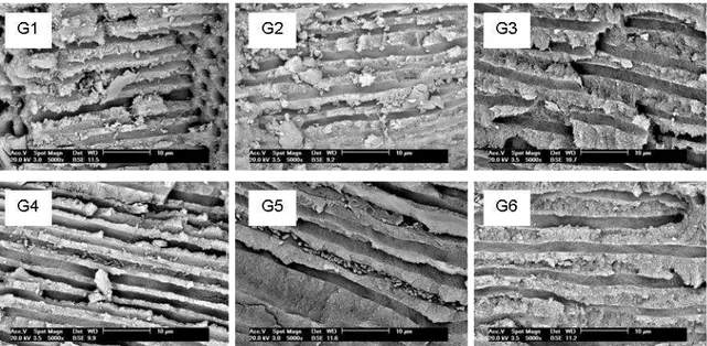 Figure 3- SEM photomicrographs (5000x  – canal wall – middle third) of groups under study –  G1: group 1; G2: group 2; G3: group 3; G4: group 4; G5: group 5; G6: group 6