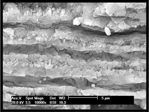 Figura 14 – magnificação de 10.000x no terço apical ao nível da interface dentinária. 