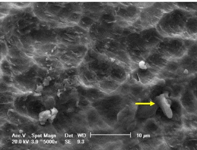 Figura 5: Fotomicrografia eletrônica de varredura da superfície do implante  Bonelike aos 14 dias de cultura