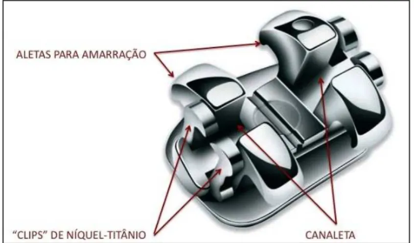Figura 2. Bráquete Autoligado SmartClip ®  (Fonte: 3M Unitek).