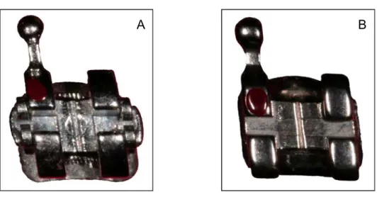 Figura 3. A) Bráquete autoligado SmartClip ®  e B) Bráquete convencional Gemini ® .