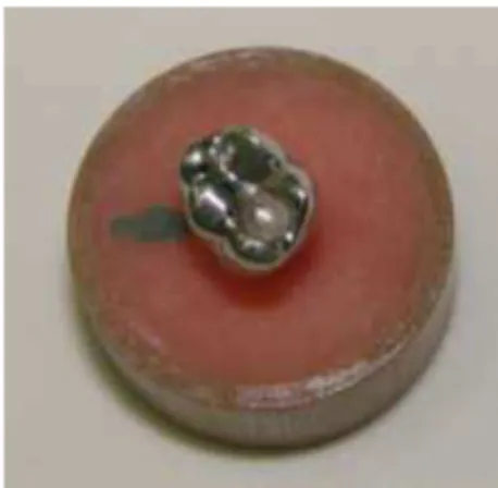 Figura 8: Coroa metálica instalada sobre o pilar protético do corpo de  prova 