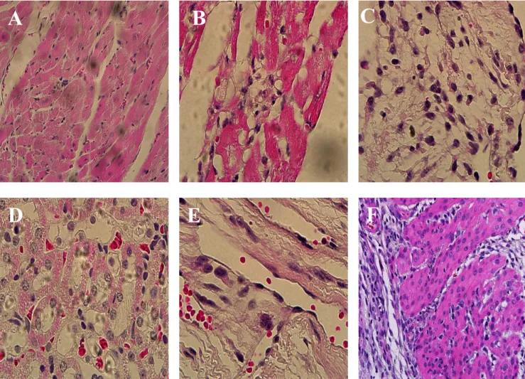 Figura 11: Aspectos histopatológicos da miocardiopatia inflamatória na doença de Chagas murina