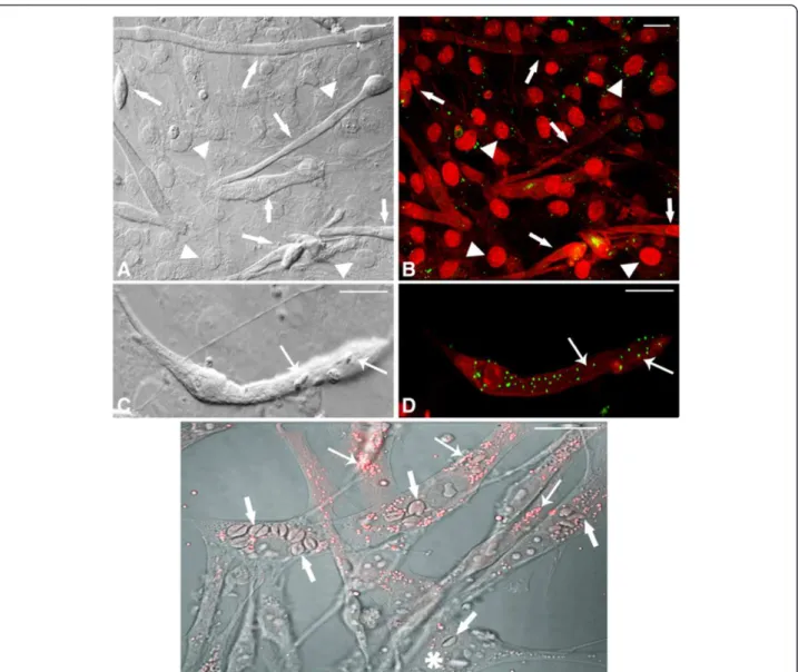 Figure 2 Confocal Laser Scanning Microscopy showing LD revealed by BODIPY in uninfected and T