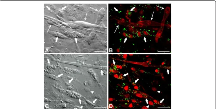 Figure 3 Confocal Laser Scanning Microscopy analysis showing LD revealed by BODIPY in T