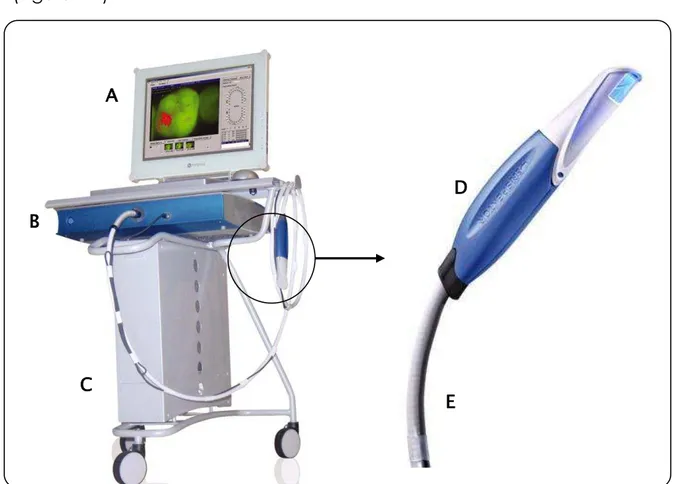 Figura 4.2 - Sistema QLF. A Monitor; B Sistema de vídeo e saída de luz para captação das                    imagens; C Unidade principal com aplicativo para análise das imagens;  