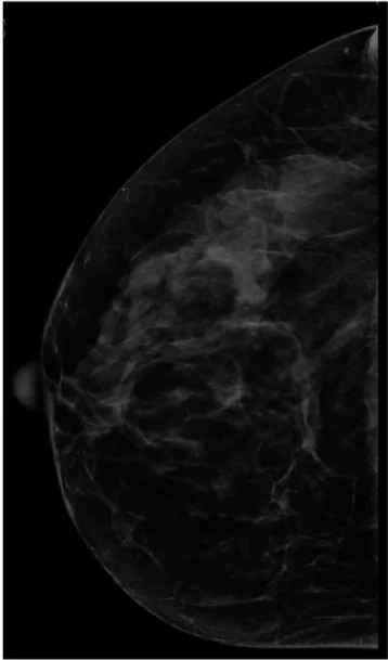 Figure 1. Full-field digital mammography image with no blur.