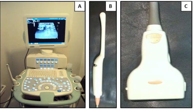Figura  1:  Equipamento  de  US  utilizado  na  pesquisa,  Toshiba  – Japan, modelo Aplio 80 (A)