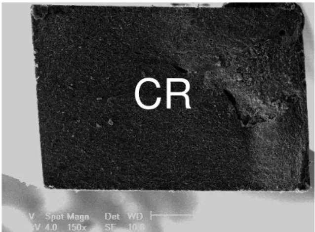 Figura 5 - Fotografia em MEV (aumento de 150x). Falha adesiva. Cimento resinoso  remanescente (CR)